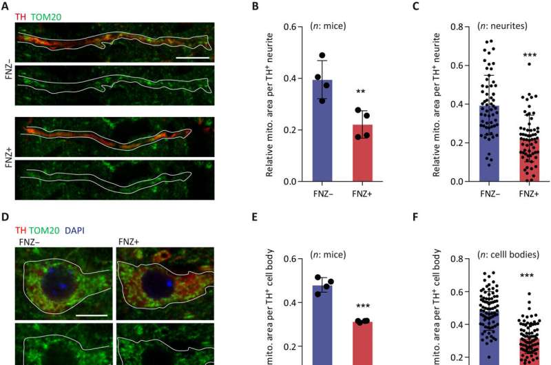 Newly discovered mechanism points to cause of drug-induced parkinsonism