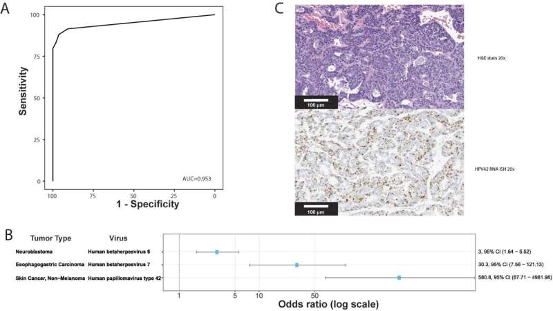 New method can easily identify viruses in tumors in a routine clinical genomic sequencing assay