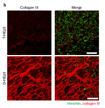 New breakthrough: This collagen can make tumor cells go dormant!