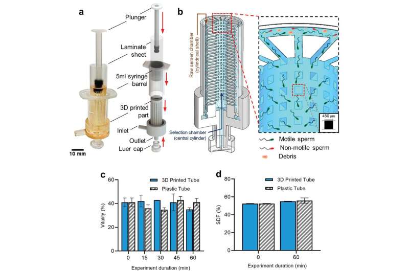 Sperm syringe offers new hope to infertile couples