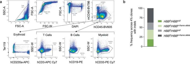 Prime editing shows proof of concept for treating sickle cell disease