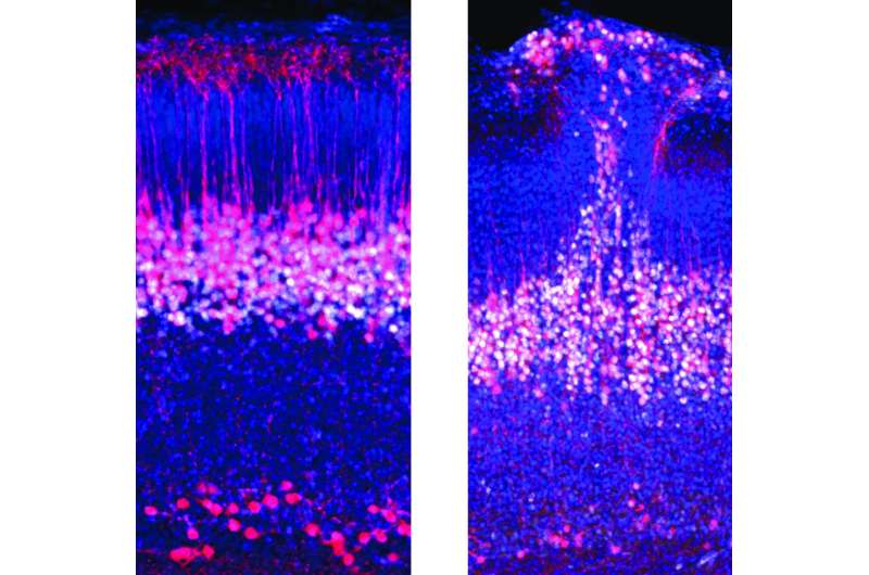 Researchers discover a new embryonic brain circuit